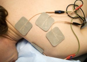 Electrotherapy pic