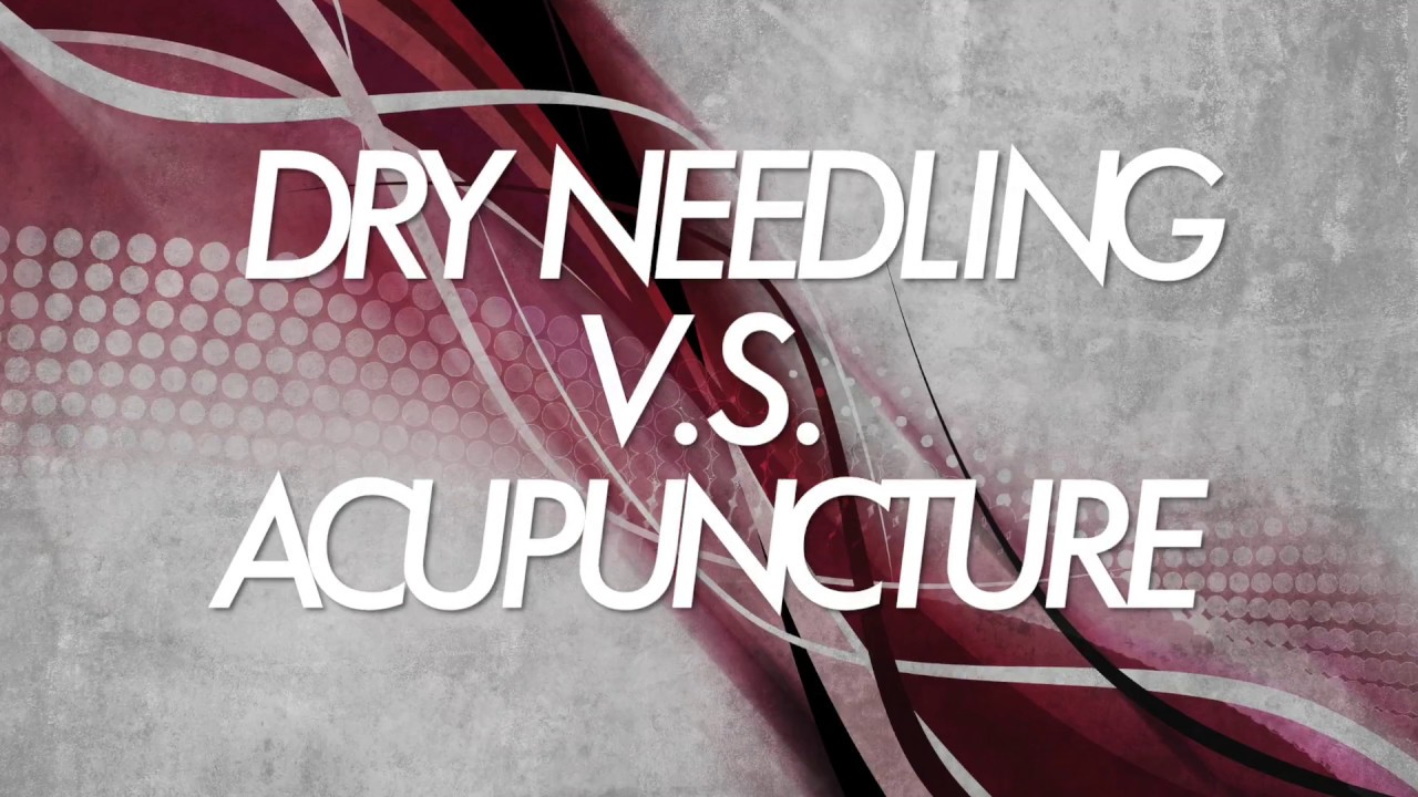 Acupuncture vs Dry Needling What's the difference? Physio Clinic