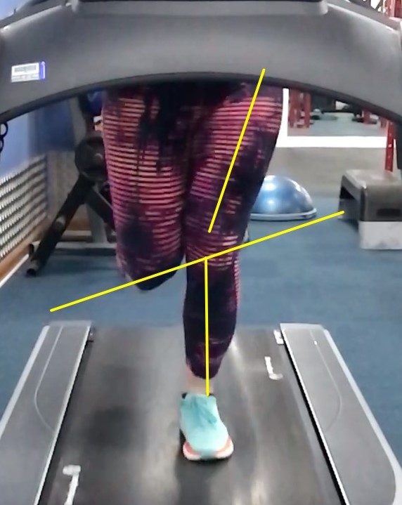 Why should you get a run analysis? Episode 2... Hip level & rotation ...